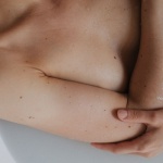 Pelle Liscia e Senza Imperfezioni: Rimedi Efficaci per Eliminare i Brufoli sul Corpo